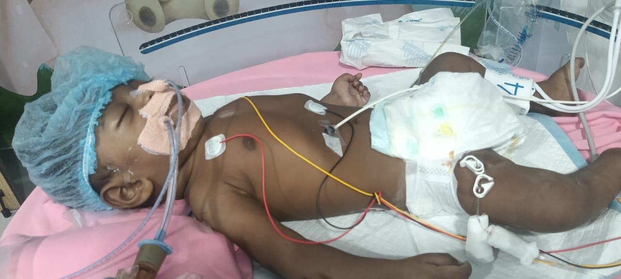 Help Save 5-Month-Old Baby Boy of Santhoshi