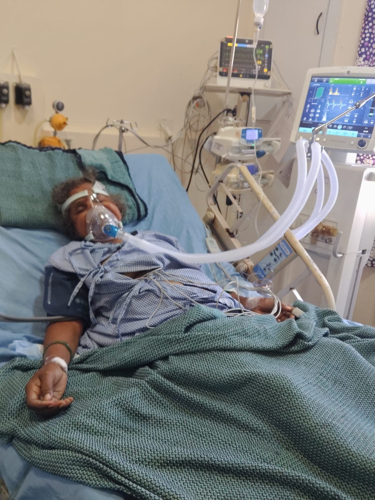 Her Heart Functions at Just 27% — Help Vidyavathi Continue Her Treatment