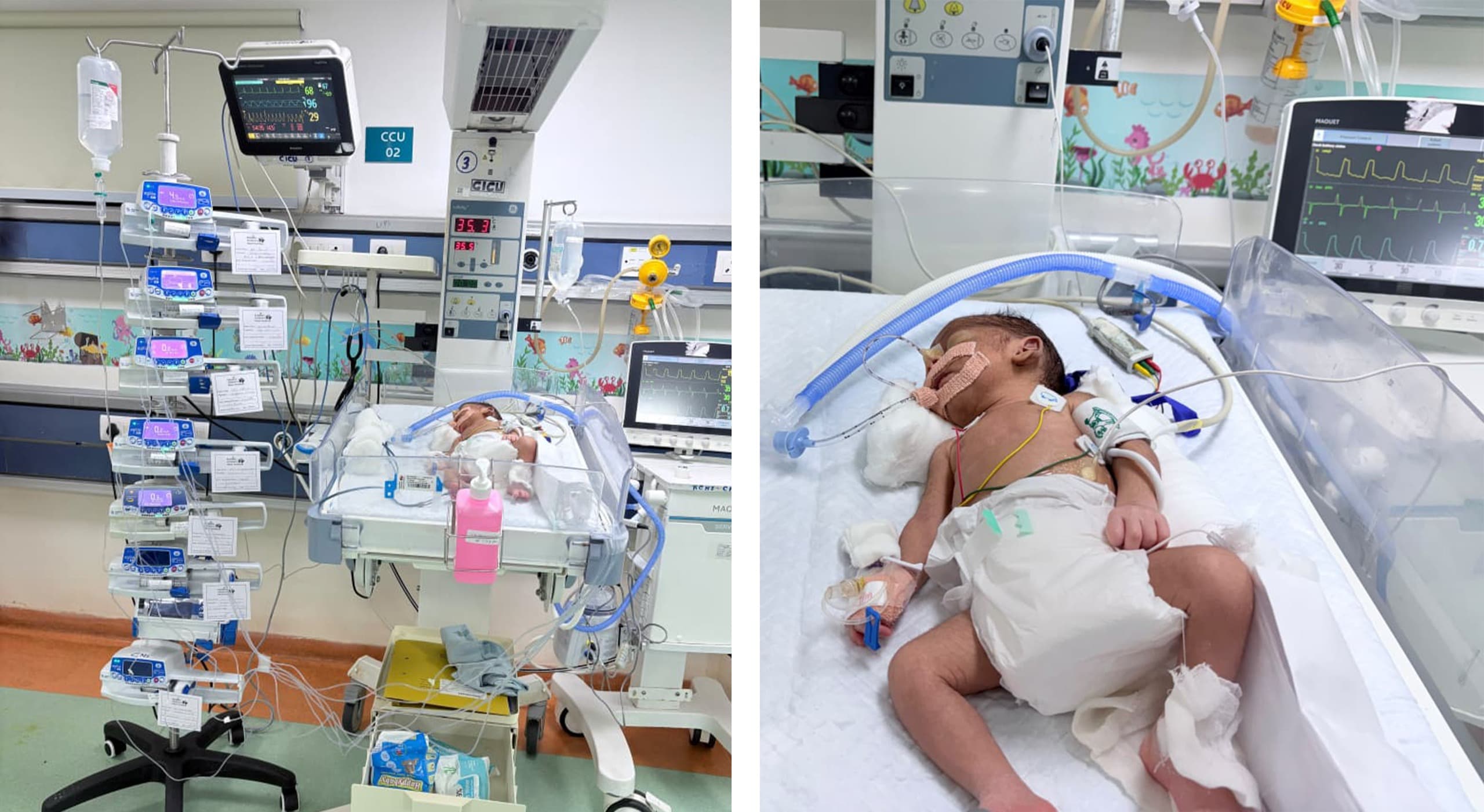 Help Akanksha's Newborn Baby Receive Life-Saving Heart Treatment