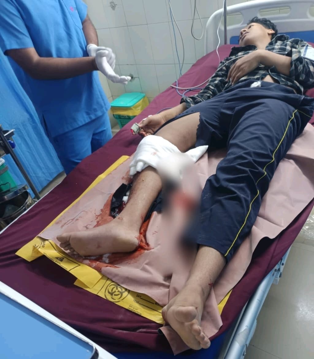 Help Save Our 16-Year-Old Son After a Devastating Road Accident